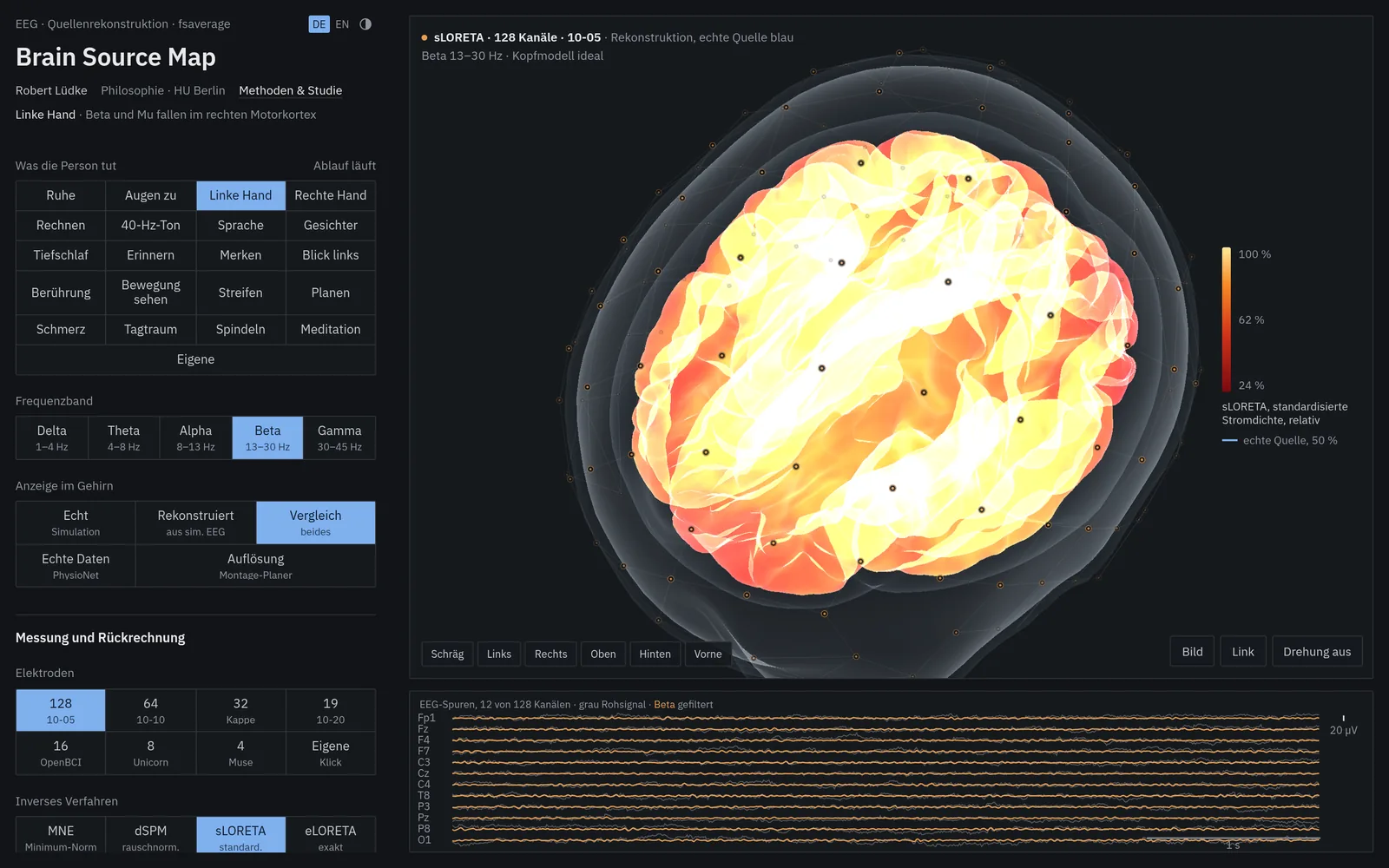 Brain Source Map in der dunklen Ansicht